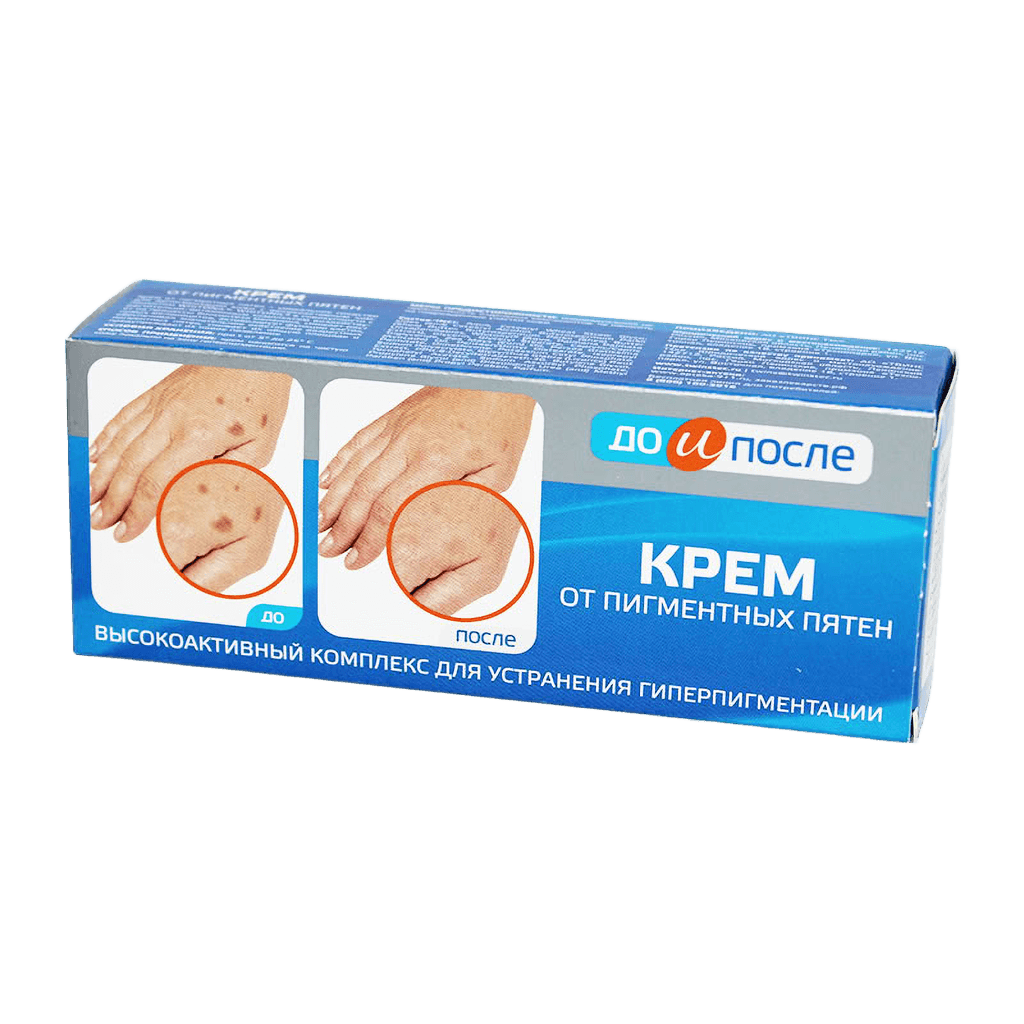 Krem ot Pigmentnykh pyaten Do i Posle, 50 ml